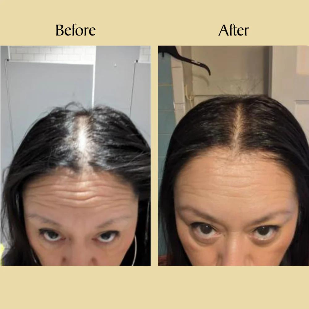 InnoGlam Hair Growth Serum