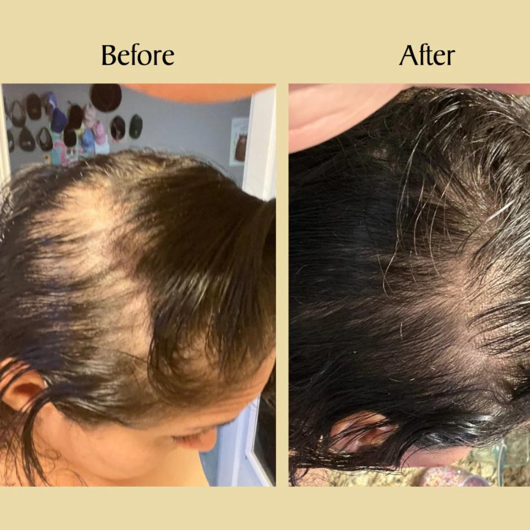 InnoGlam Hair Growth Serum